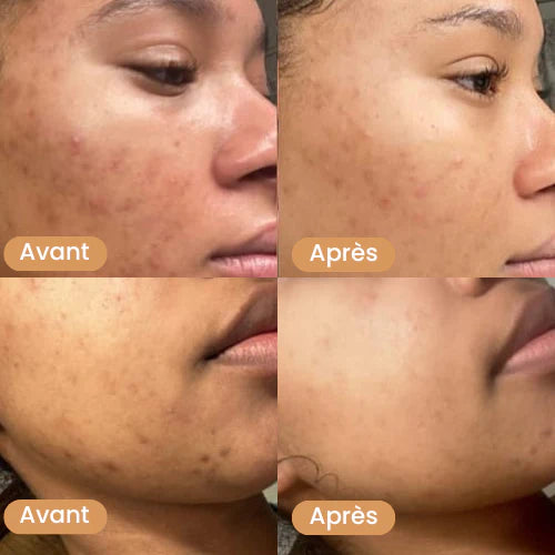 Coton Nettoyants au Curcuma 3 en 1