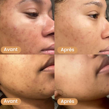 Coton Nettoyants au Curcuma 3 en 1